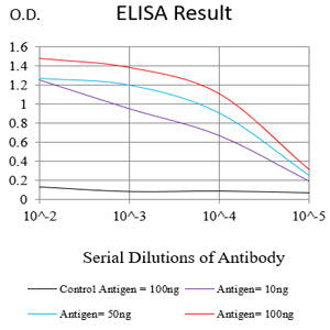 Figure1:Black line: Control Antigen (100 ng);Purple line: Antigen (10ng); Blue line: Antigen (50 ng); Red line:Antigen (100 ng)