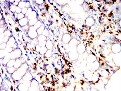 Figure 5:Immunohistochemical analysis of paraffin-embedded colon tissues using CD45R mouse mAb with DAB staining.