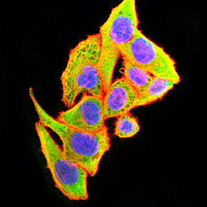 Figure 4:Immunofluorescence analysis of Hela cells using SLC2A14 mouse mAb (green). Blue: DRAQ5 fluorescent DNA dye. Red: Actin filaments have been labeled with Alexa Fluor- 555 phalloidin. Secondary antibody from Fisher (Cat#: 35503)