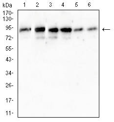 Figure 3:Western blot analysis using XPC mouse mAb against SW480(1) ,A431(2) ,T47D(3) ,HT-29(4) ,A549 (5)and C2C12(6) cell lysate.