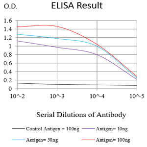 Figure 1:Black line: Control Antigen (100 ng);Purple line: Antigen (10ng); Blue line: Antigen (50 ng); Red line:Antigen (100 ng)