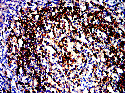 Figure 6:Immunohistochemical analysis of paraffin-embedded human tonsil tissues using HLA-DRB1 mouse mAb with DAB staining.