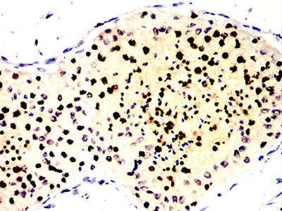 Figure 6:Immunohistochemical analysis of paraffin-embedded testis tissues using RBMXL3 mouse mAb with DAB staining.