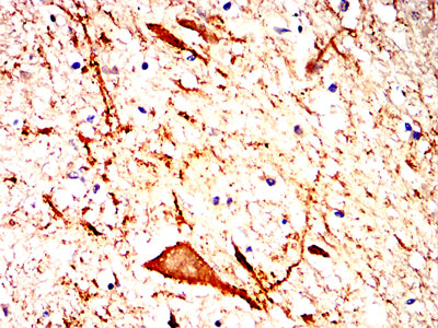 Figure 5:Immunohistochemical analysis of paraffin-embedded brain tissues using LRRK2 mouse mAb with DAB staining.