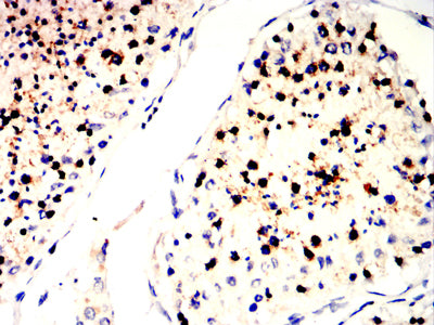 Figure 6:Immunohistochemical analysis of paraffin-embedded testis tissues using SLC7A3 mouse mAb with DAB staining.