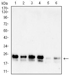 Figure 4:Western blot analysis using PARK7 mouse mAb against A549 (1), A431 (2),K562 (3),Hela(4), SH-SY5Y (5) and SW480 (6) cell lysate.