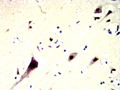 Figure 6:Immunohistochemical analysis of paraffin-embedded human brain tissues using NPM2 mouse mAb with DAB staining.