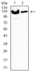 Figure 3:Western blot analysis using XPC mouse mAb against Jurkat (1) and Hela (2) cell lysate.