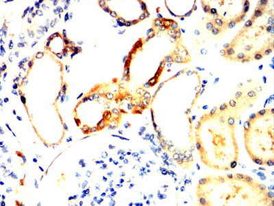 Figure 5:Immunohistochemical analysis of paraffin-embedded kidney tissues using M6PR mouse mAb with DAB staining.