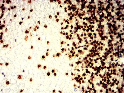 Figure 5:Immunohistochemical analysis of paraffin-embedded cerebellum tissues using H2AFX mouse mAb with DAB staining.