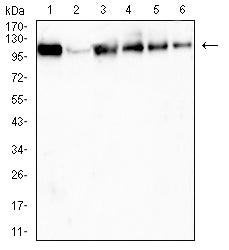 Figure 1:Western blot analysis using USP11 mouse mAb against Hela (1), LNcap (2), HepG2 (3), K562 (4), A549 (5) and Jurkat (6) cell lysate.