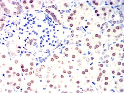 Figure 10:Immunohistochemical analysis of paraffin-embedded rabbit kidney tissues using HNF1B mouse mAb with DAB staining.