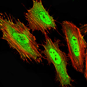 Figure 5:Immunofluorescence analysis of Hela cells using HNF1B mouse mAb (green). Blue: DRAQ5 fluorescent DNA dye. Red: Actin filaments have been labeled with Alexa Fluor- 555 phalloidin. Secondary antibody from Fisher (Cat#: 35503)