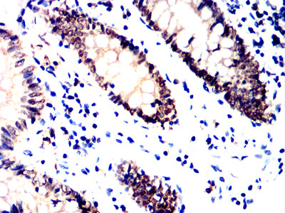 Figure 8:Immunohistochemical analysis of paraffin-embedded colon tissues using HNF1B mouse mAb with DAB staining.