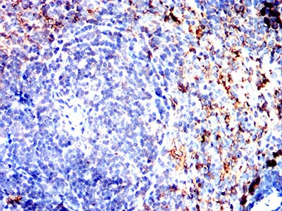 Figure 7:Immunohistochemical analysis of paraffin-embedded mouse spleen tissues using S100A4 mouse mAb with DAB staining.