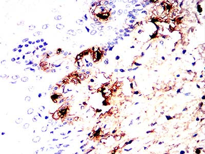 Figure 10:Immunohistochemical analysis of paraffin-embedded esophageal tissue tissues using TPSAB1 mouse mAb with DAB staining.