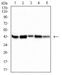 Figure 4:Western blot analysis using PDHA1 mouse mAb against HepG2 (1), HL-60 (2),SK-OV-3 (3),PC-3 (4) and PANC-1 (5) cell lysate.