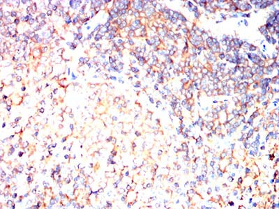 Figure 11:Immunohistochemical analysis of paraffin-embedded rat spleen tissues using C9orf72 mouse mAb with DAB staining.