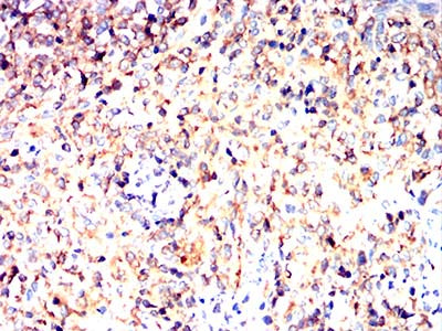 Figure 13:Immunohistochemical analysis of paraffin-embedded rabbit spleen tissues using C9orf72 mouse mAb with DAB staining.