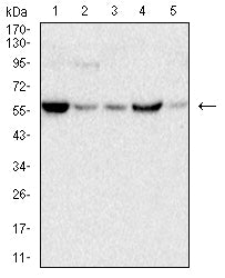 Figure 4:Western blot analysis using C9orf72 mouse mAb against C6 (1), PC-12 (2),COS-7 (3),NIH/3T3 (4) and SK-N-SH (5) cell lysate.