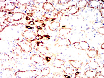 Figure 10:Immunohistochemical analysis of paraffin-embedded Rabbit kidney tissues using S100A4 mouse mAb with DAB staining.