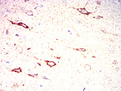 Figure 10:Immunohistochemical analysis of paraffin-embedded Rat cerebrum tissues using ZP2 mouse mAb with DAB staining.