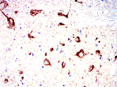 Figure 12:Immunohistochemical analysis of paraffin-embedded Rabbit spinal cord tissues using ZP2 mouse mAb with DAB staining.