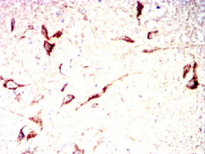 Figure 14:Immunohistochemical analysis of paraffin-embedded rabbit brain tissues using IRF3 mouse mAb with DAB staining.