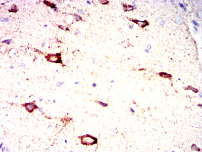 Figure 12:Immunohistochemical analysis of paraffin-embedded rat brain tissues using IRF3 mouse mAb with DAB staining.