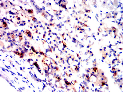 Figure 5:Immunohistochemical analysis of paraffin-embedded human hypophysis tissues using FSHB mouse mAb with DAB staining.