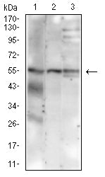 Figure 2:Western blot analysis using MUC13 mouse mAb against HT-19 (1), SW620 (2), and NIH/3T3 (3) cell lysate.