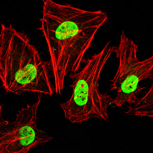 Figure 2:Immunofluorescence analysis of Hela cells using ATM mouse mAb (green). Blue: DRAQ5 fluorescent DNA dye. Red: Actin filaments have been labeled with Alexa Fluor- 555 phalloidin. Secondary antibody from Fisher (Cat#: 35503)