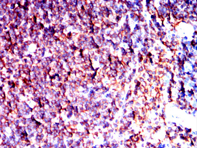 Figure 8:Immunohistochemical analysis of paraffin-embedded Mouse spleen tissues using ATM mouse mAb with DAB staining.