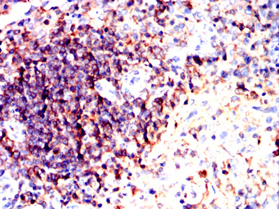 Figure 10:Immunohistochemical analysis of paraffin-embedded Rabbit spleen tissues using ATM mouse mAb with DAB staining.