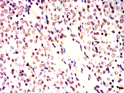 Figure 7:Immunohistochemical analysis of paraffin-embedded Rat kidney tissues using ATM mouse mAb with DAB staining.