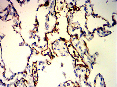 Figure 6:Immunohistochemical analysis of paraffin-embedded lung tissues using CD109 mouse mAb with DAB staining.