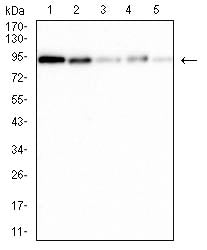 Figure 4:Western blot analysis using XRCC1 mouse mAb against Hela (1), Jurkat (2),k562 (3),SK-OV-3 (4), and COS-7 (5) cell lysate.