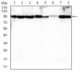 Figure 4:Western blot analysis using BCL2 mouse mAb against Raji (1), MCF-7 (2), Jurkat (3), A549 (4), HEK293 (5), T47D (6), Hela (7), and C6 (8) cell lysate.