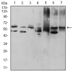 Figure 4:Western blot analysis using KRT9 mouse mAb against HepG2 (1), MCF-7 (2), NIH/3T3 (3), rat heart (4), mouse heart (5), Hela (6), and HUVEC (7) cell lysate.