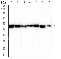 Figure 4:Western blot analysis using TUBB1 mouse mAb against K562 (1), HepG2 (2), A431 (3), Jurkat (4), Hela (5), NIH/3T3 (6), and COS-7 (7) cell lysate.