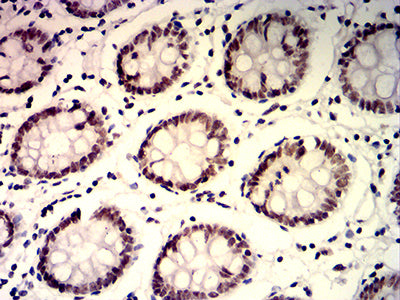 Figure 6:Immunohistochemical analysis of paraffin-embedded colon tissues using PDLIM7 mouse mAb with DAB staining.