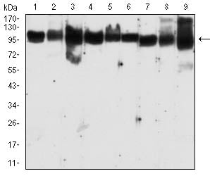 Figure 6:Western blot analysis using MSH2 mouse mAb against MCF-7 (1), A431 (2),K562 (3),Hela (4),Raji (5),A549 (6),NIH/3T3 (7),cos-7 (8), and Hek293-e6 (9) cell lysate.