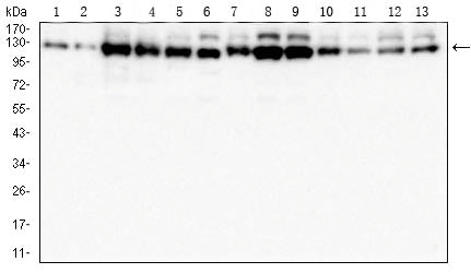 Figure 4:Western blot analysis using *** mouse mAb against Hela (1), A431 (2), MCF-7 (3),Jurkat (4),K562 (5),HepG2 (6),A549 (7),HCT116 (8),HT-29 (9),SW480 (10),C6 (11),COS-7 (12),and NIH/3T3 (13) cell lysate.