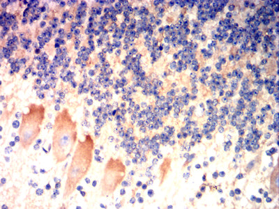 Figure 8:Immunohistochemical analysis of paraffin-embedded cerebellar tissues using BRAF mouse mAb with DAB staining.