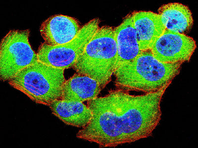 Figure 5:Immunofluorescence analysis of Hela cells using TRIB2 mouse mAb (green). Blue: DRAQ5 fluorescent DNA dye. Red: Actin filaments have been labeled with Alexa Fluor- 555 phalloidin. Secondary antibody from Fisher (Cat#: 35503)