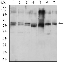 Figure 4:Western blot analysis using KRT9 mouse mAb against HepG2 (1), MCF-7 (2), NIH/3T3 (3), rat heart (4), mouse heart (5), Hela (6), and HUVEC (7) cell lysate.