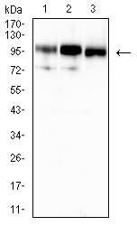 Figure 4:Western blot analysis using CD10 mouse mAb against Raji (1), Ramos (2), and LNcap (3) cell lysate.