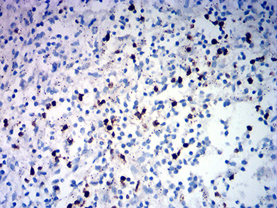 Figure 5:Immunohistochemical analysis of paraffin-embedded spleen tissues using TRBC1 mouse mAb with DAB staining.