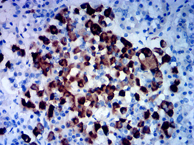 Figure 4:Immunohistochemical analysis of paraffin-embedded hypophysis tissues using ACTH mouse mAb with DAB staining.