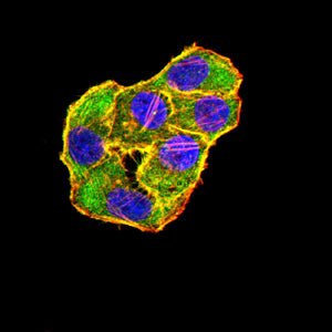 Figure 7:Immunofluorescence analysis of Hela cells using TLR10 mouse mAb (green). Blue: DRAQ5 fluorescent DNA dye. Red: Actin filaments have been labeled with Alexa Fluor- 555 phalloidin. Secondary antibody from Fisher (Cat#: 35503)